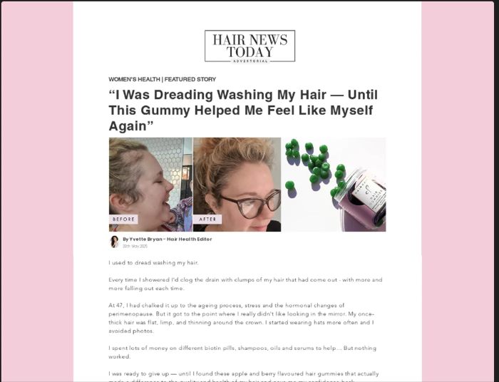 Hair Gain advertorial hero