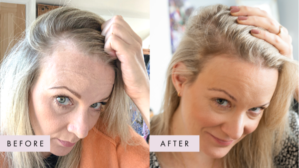 Hair Gain ad